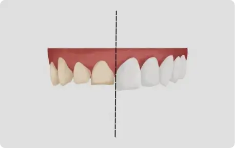 Patient Stories: Cosmetic Dentistry in Albania That Changed Real Lives